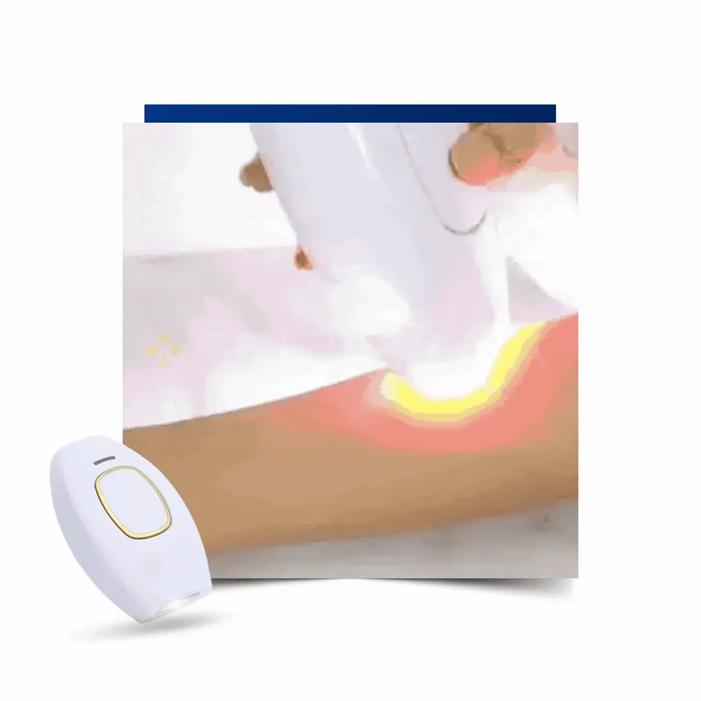 1GIFDEPILADORLASERVICENTE ezgif.com gif to webp converter