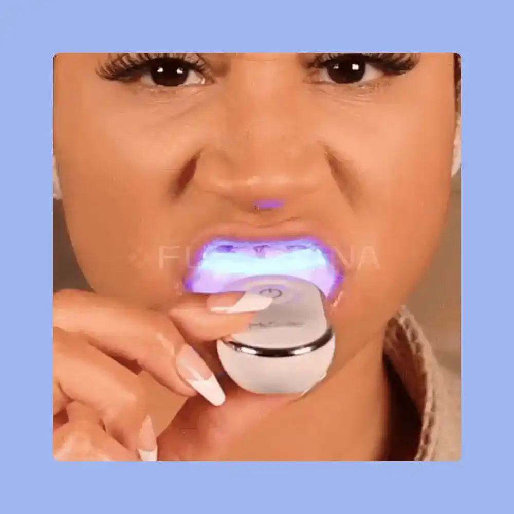 GIF BLANQUEAMINETODENTALVICENTE 11 ezgif.com optiwebp