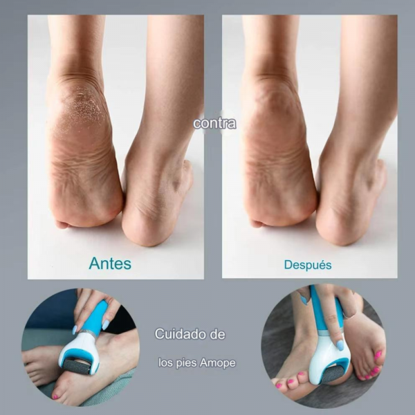 Inserir um subtitulo 18