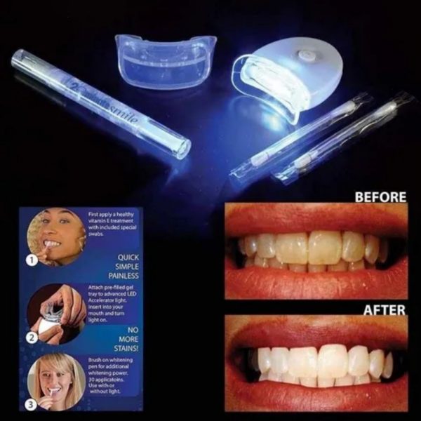 kit blanqueamiento dental profesional 20 minutos almacenes denuevoo 1131526439 4