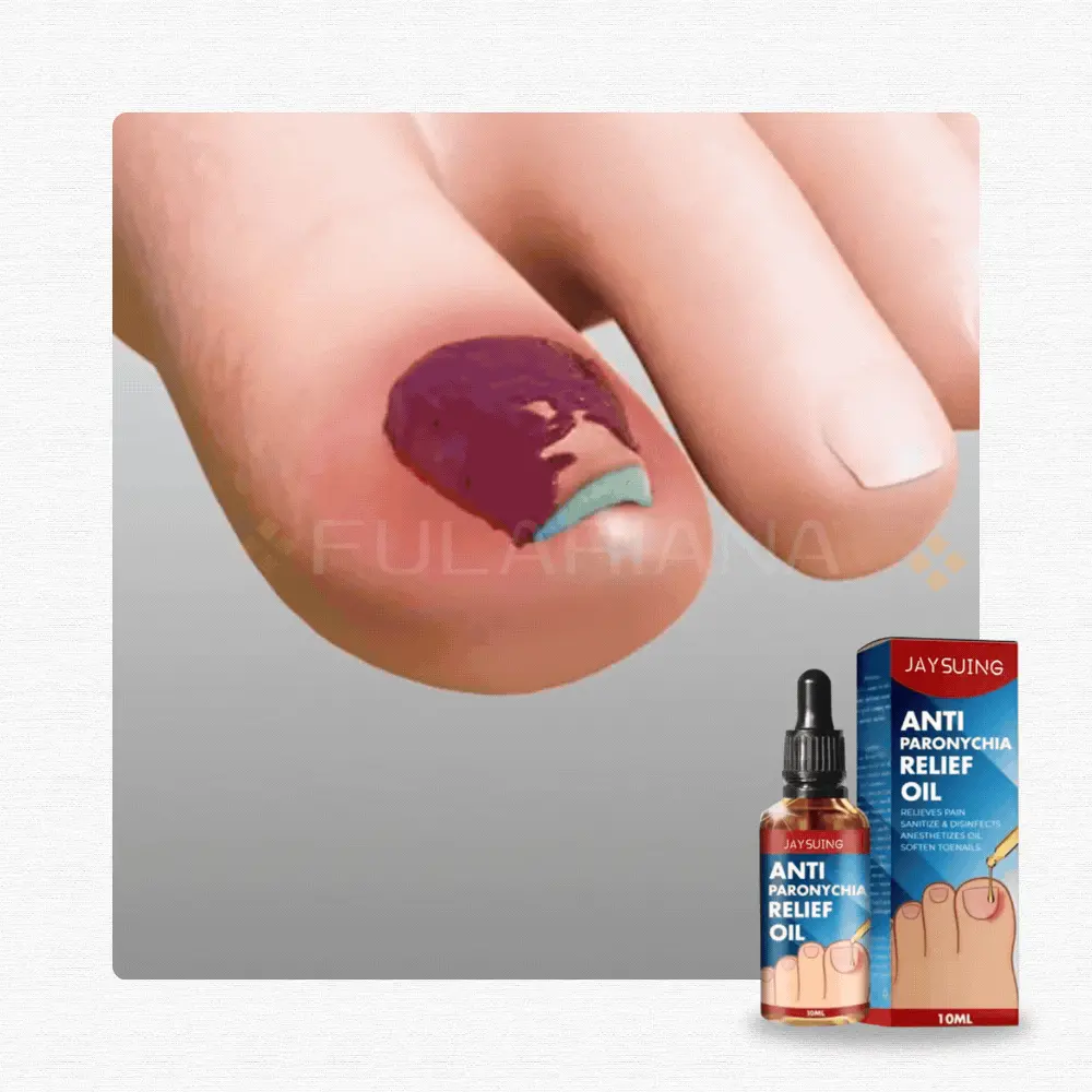 GIF ANTIFUNGOSVICENTE ezgif.com gif to webp converter