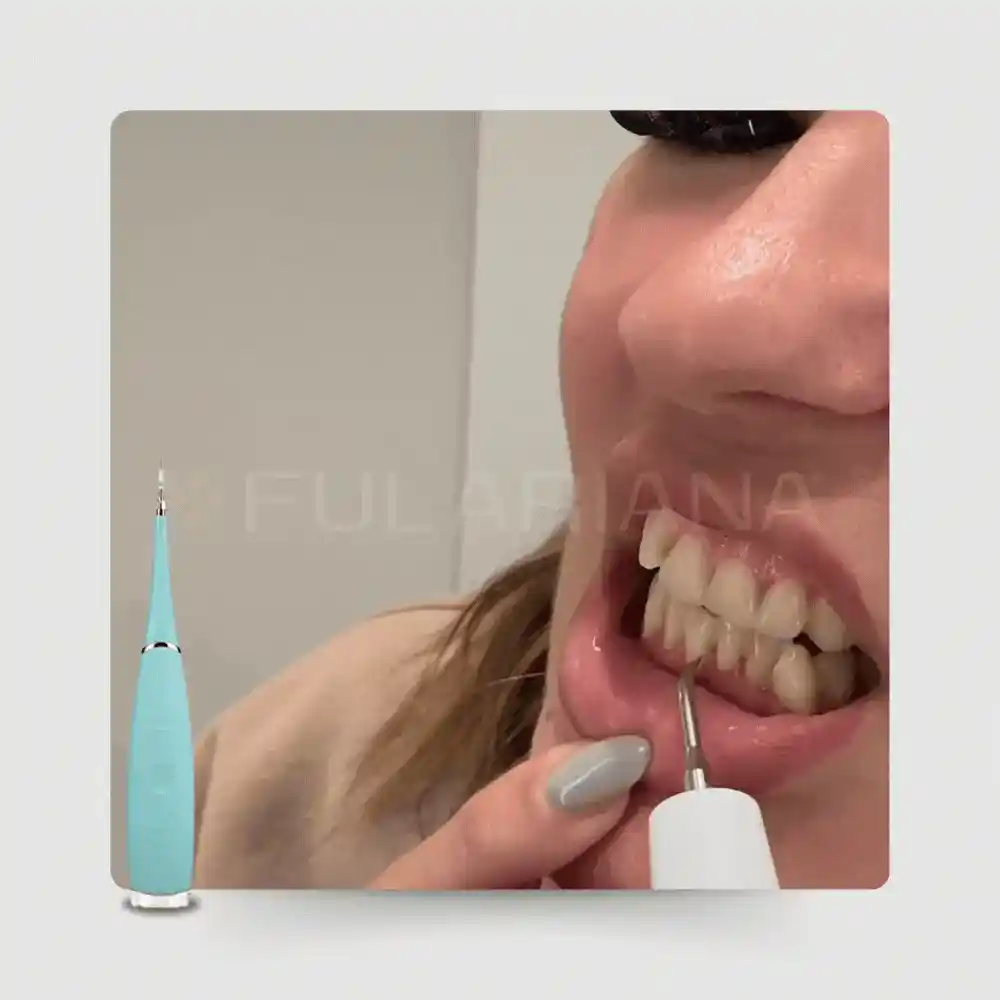 GIF CEPILLODENTRALVICENTE ezgif.com optiwebp