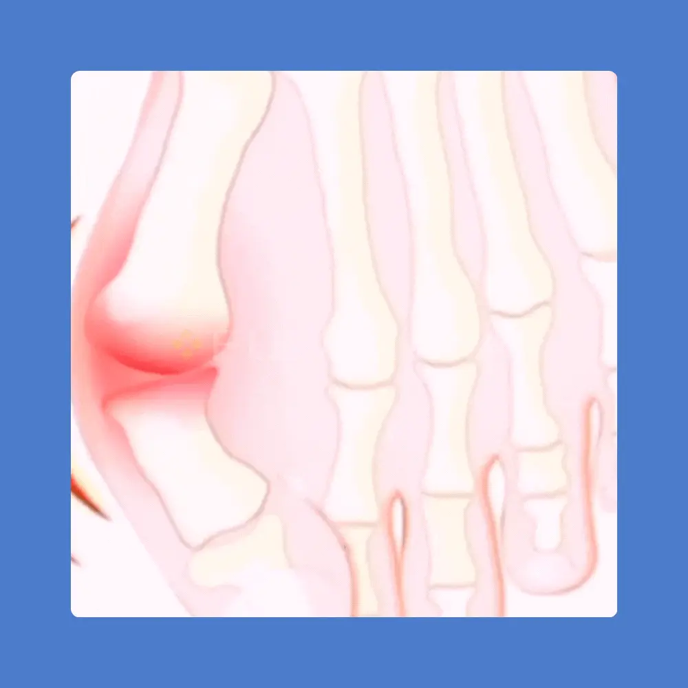 GIF JUANETEPLASTICOVICENTE 2 ezgif.com gif to webp converter