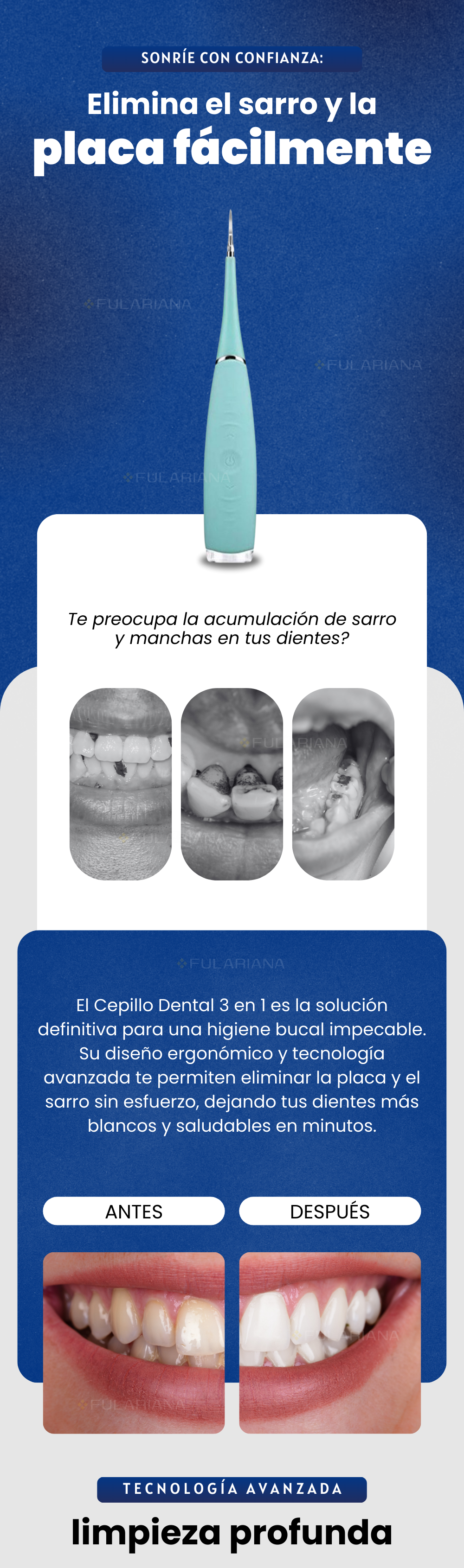 LP CEPILLO DENTRAL VICENTE PART 1