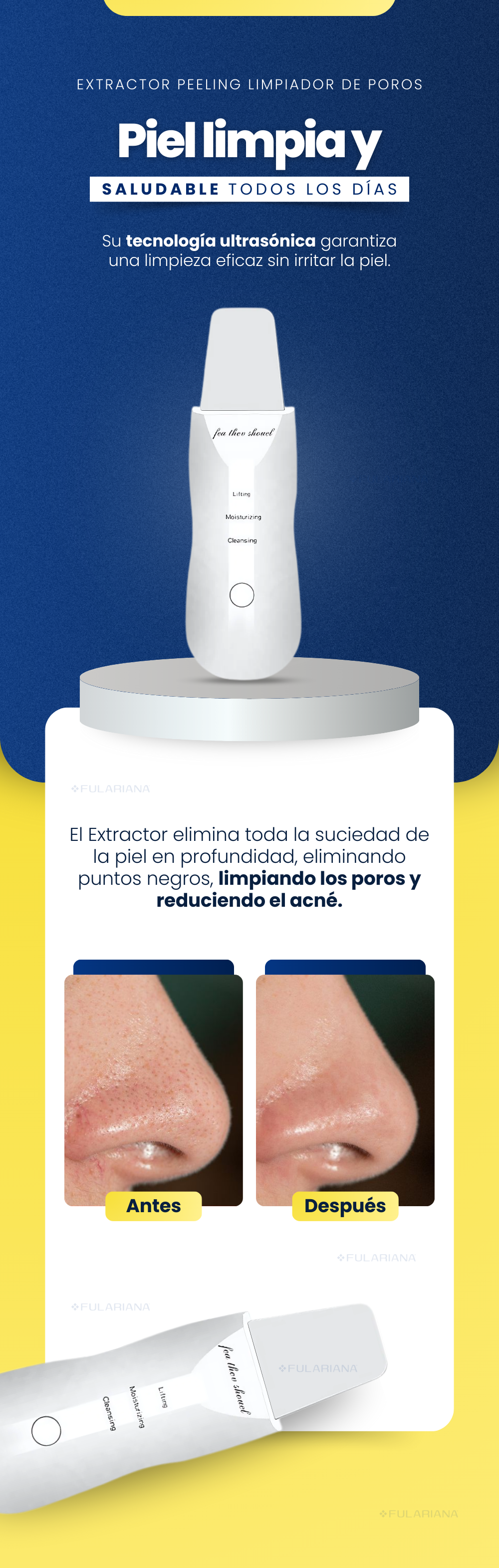 LP1 EXTRACTOR PEELING VICENTE