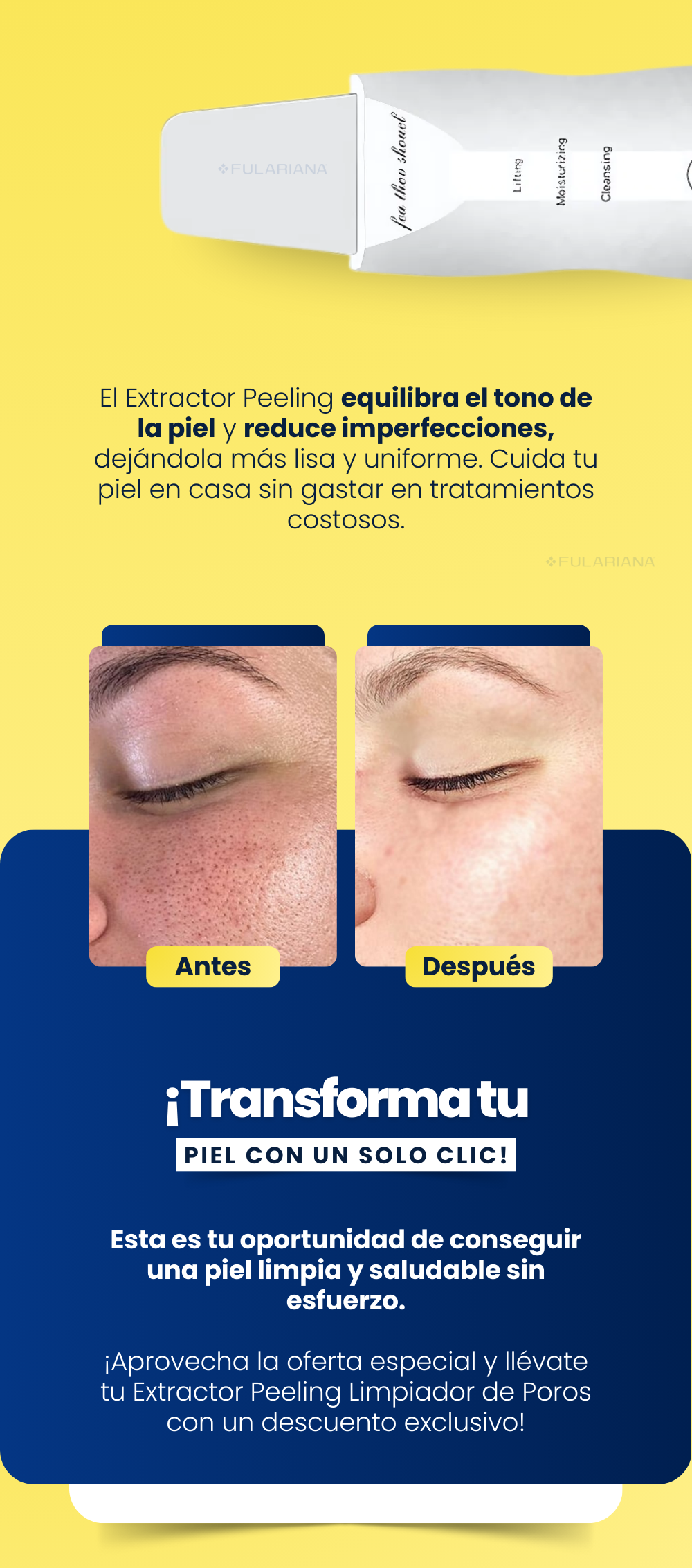 LP3 EXTRACTOR PEELING VICENTE 1