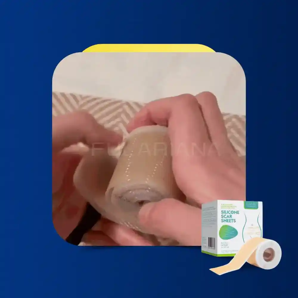 Cinta cicatrizante - Quitar Cicatrices 5 GIFCINTACICATRIZANTEVICENTE ezgif.com optiwebp