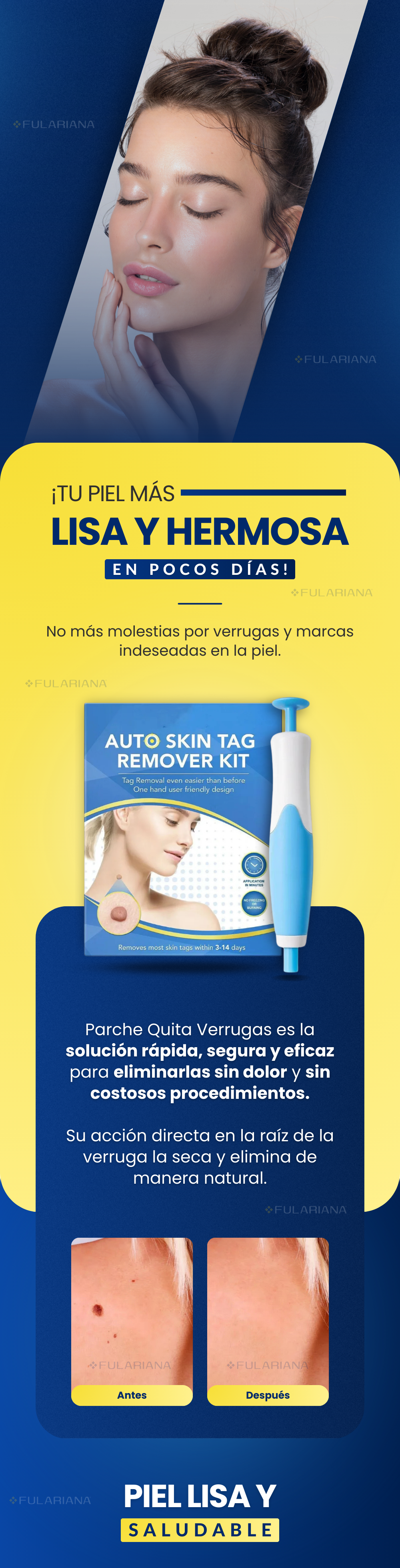 Parche Quita Verrugas 4 LP1 PARCHE QUITA VERRUGAS VICENTE